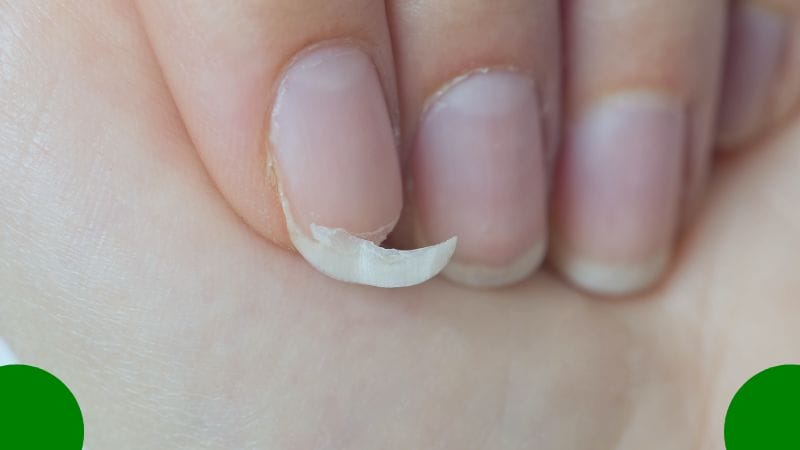 Do Fingernails Decompose? Exploring the Biodegradability of Fingernails Over Time 3 do fingernails decompose blog cover